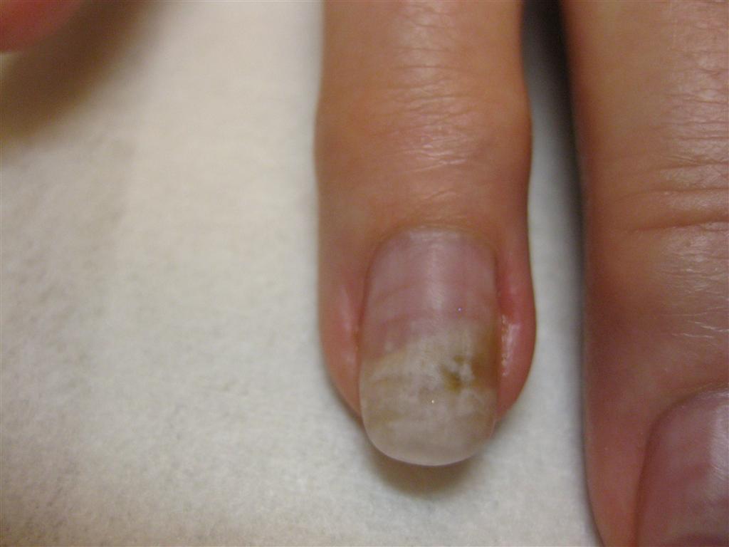 Does nail polish cause nail fungus? | Rainbow Nails' Blog