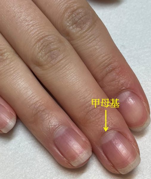 Why did my Nail Lift Up and Break off? | Rainbow Nails' Blog